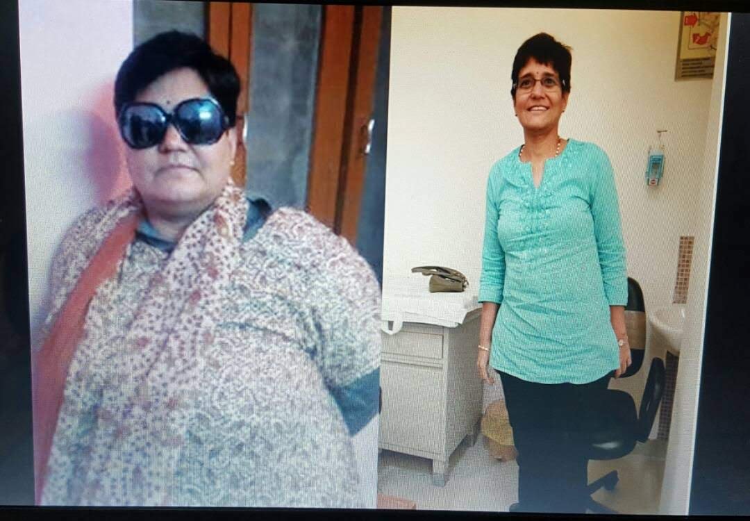 Before after transformation